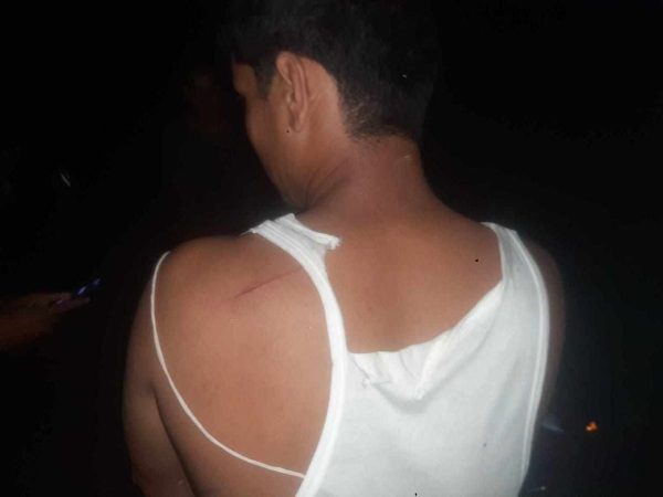 टीकापुरमा एकै व्यक्ति माथि एक महिनामा दुई पटक खुकुरी प्रहार