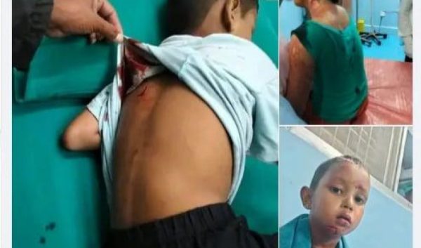 बझाङको चैनपुरमा एक परिवारमाथि मध्यरातिमा अज्ञात व्यक्तिले खुकुरी प्रहार