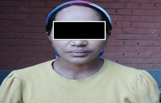 टर्की पठाइदिन्छु भनेर १ करोड १६ लाख रुपैयाँ ठगी गर्ने सुरुची पक्राउ